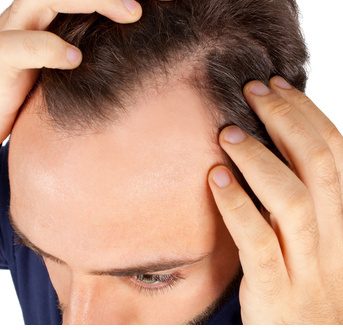 Zum Haareraufen – die besten Tipps bei Haarausfall